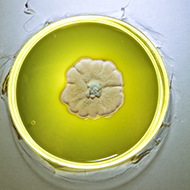 A petri dish of electric green-yellow fungi